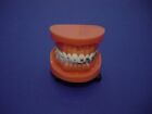 Modello dentale ortodontico brackets metallo e ceramica orthodontic half model