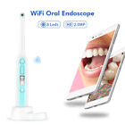 Telecamera intraorale wifi wireless dentista USB Endoscopio 8 LED Dentale