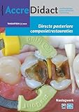 Directe posteriore composietrestauraties