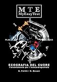 Ecografia del Cuore - MyEasyTest