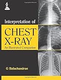 Interpretation of Chest X-Ray: An Illustrated Companion by G. Balachandran (2014-07-01)